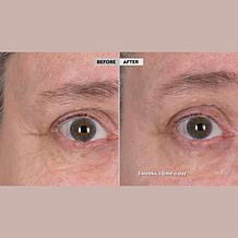 Perlier 4.6 oz Royal Elixir Youth Creator Serum - Auto-Ship®