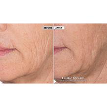 Perlier 4.6 oz Royal Elixir Youth Creator Serum - Auto-Ship®