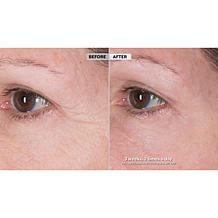 Perlier 4.6 oz Royal Elixir Youth Creator Serum - Auto-Ship®