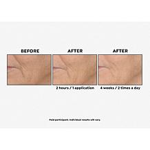 Perlier Black Rice 94.5% Pure Hyaluronic Acid Gel