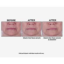 Perlier Black Rice Booster Serum 1 fl. oz. Auto-Ship®