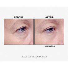 Perlier Black Rice Flash Effect Eye Serum