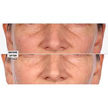 Perlier Black Rice Niacinamide Concentrate Auto-Ship®