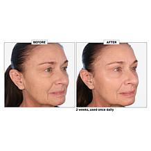 Perlier Black Rice Resurfacing Pads - 60-Count Auto-Ship®