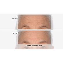 Perlier Black Rice Resurfacing Pads - 60-Count Auto-Ship®