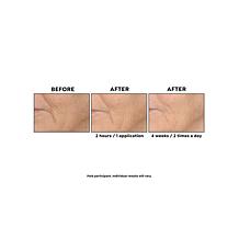 Perlier Black Rice Triple-Size Hyaluronic Acid Gel