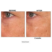 Perlier Black Rice Triple Sized Night Eye Contour Serum