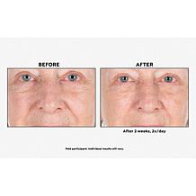 Perlier Black Rice Ultra Renewing Face Serum