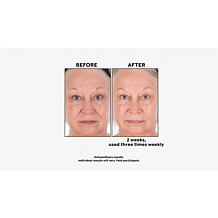 Perlier Bonus Size Royal Elixir Face Mask Auto-Ship®