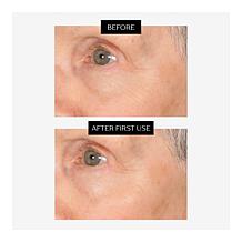 Perlier Jumbo Black Rice Super Concentrate 9x Hyaluronic Acid