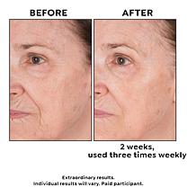 Perlier Jumbo Royal Elixir Face Mask
