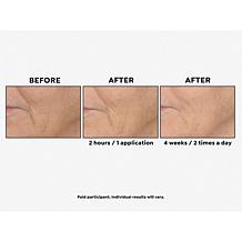 Perlier Megasize Black Rice Hyaluronic Acid Gel