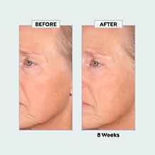 Perlier Royal Elixir Extreme Timecode Serum