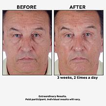 Perlier Royal Elixir Face Cream Auto-Ship®