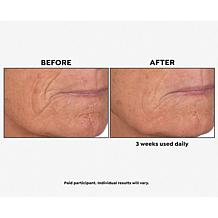 Perlier Royal Elixir Pearls of Youth Alcohol-Free Serum