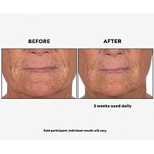 Perlier Royal Elixir Pearls of Youth Alcohol-Free Serum Auto-Ship®