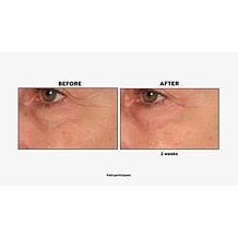 Perlier Royal Elixir Youth Oil 1.5oz Bonus Size