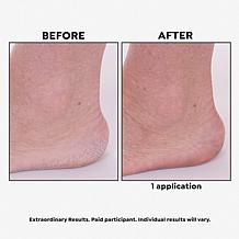 Perlier White Almond Nourishing Pearl Body Cream 10.1 oz.