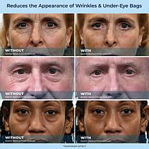 Plexaderm Rapid Reduction Serum 2-pack & Dual Action Cream Auto-Ship®