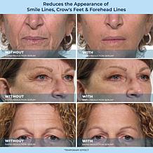 Plexaderm Rapid Reduction Wrinkle Serum 2-pack Auto-Ship®