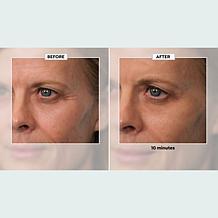 Plexaderm Rapid Reduction Wrinkle Serum 2-pack