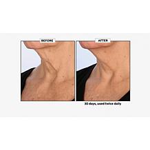PRAI Ageless Throat and Decolletage Creme Auto-Ship®