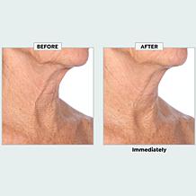 PRAI Beauty AGELESS 3-Pack Throat & Décolletage Hydrogel Masks
