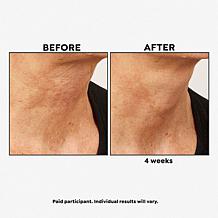 PRAI Beauty Ageless Throat Caviar Overnight Recovery Serum Auto-Ship®