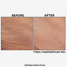 PRAI Beauty Ageless Upper Arm Creme