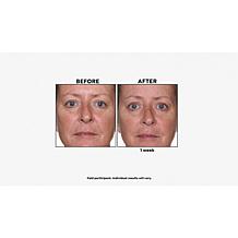 PRAI Beauty PLATINUM Night Cavier Firm & Lift Serum