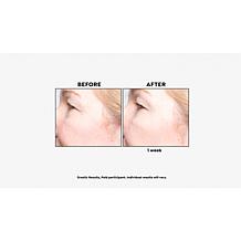 PRAI Platinum Firm & Lift Eye Serum Auto-Ship®