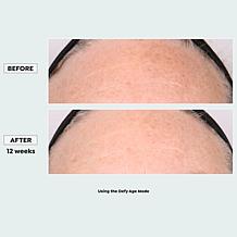 Sharper Image Revel LED Light Therapy Face Mask