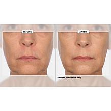 Signature Club A 5 Essentials Cream for Face and Eyes Auto-Ship®