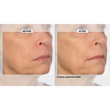 Signature Club A 5 Essentials Cream for Face and Eyes