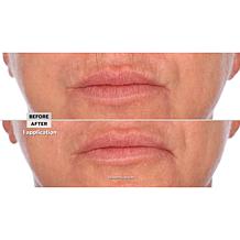 Signature Club A Intensive Lip Fix Cream Auto-Ship®