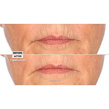 Signature Club A Intensive Lip Fix Cream