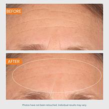 SKINN 3-piece Lab Insider Face Boot Camp Set Auto-Ship®