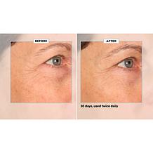 SKINN 30-Day Eye Boot Camp Auto-Ship®