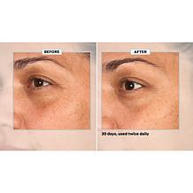 SKINN 30-Day Eye Boot Camp