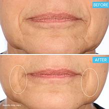 SKINN Age Reset Advanced Night Cream Auto-Ship®