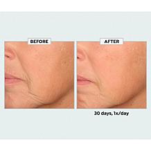 SKINN Age Reset Advanced Night Cream Auto-Ship®