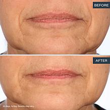 SKINN Age Reset Advanced Night Cream Auto-Ship®