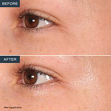 SKINN Age Reset Anhydrous Eye Balm