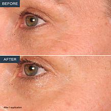 SKINN Age Reset Eye Serum + Balm Duo