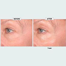 SKINN Age Reset Illuminate Eye Serum