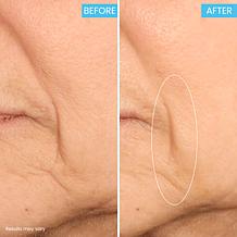 SKINN Age Reset Night Cream and Refill Auto-Ship®