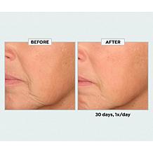 SKINN Age Reset Night Cream + Serum