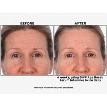 SKINN Age Reset Serum and Headband 2-piece Set Auto-Ship®