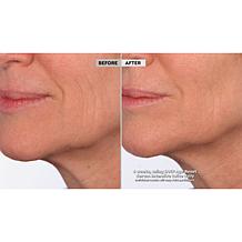 SKINN Age Reset Serum Auto-Ship®