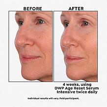 SKINN Age Reset Serum